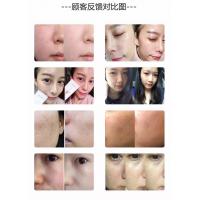 Ojesh Lifting Treatment 7ampullen